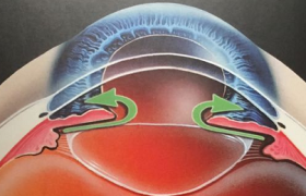 青白联合 共筑光明——2026何氏眼科青光眼白内障联合防治月启幕